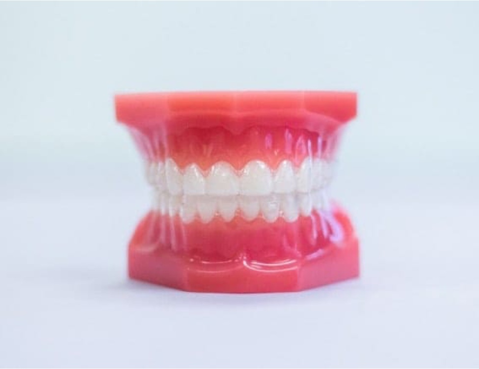 Clear Aligners on plastic model